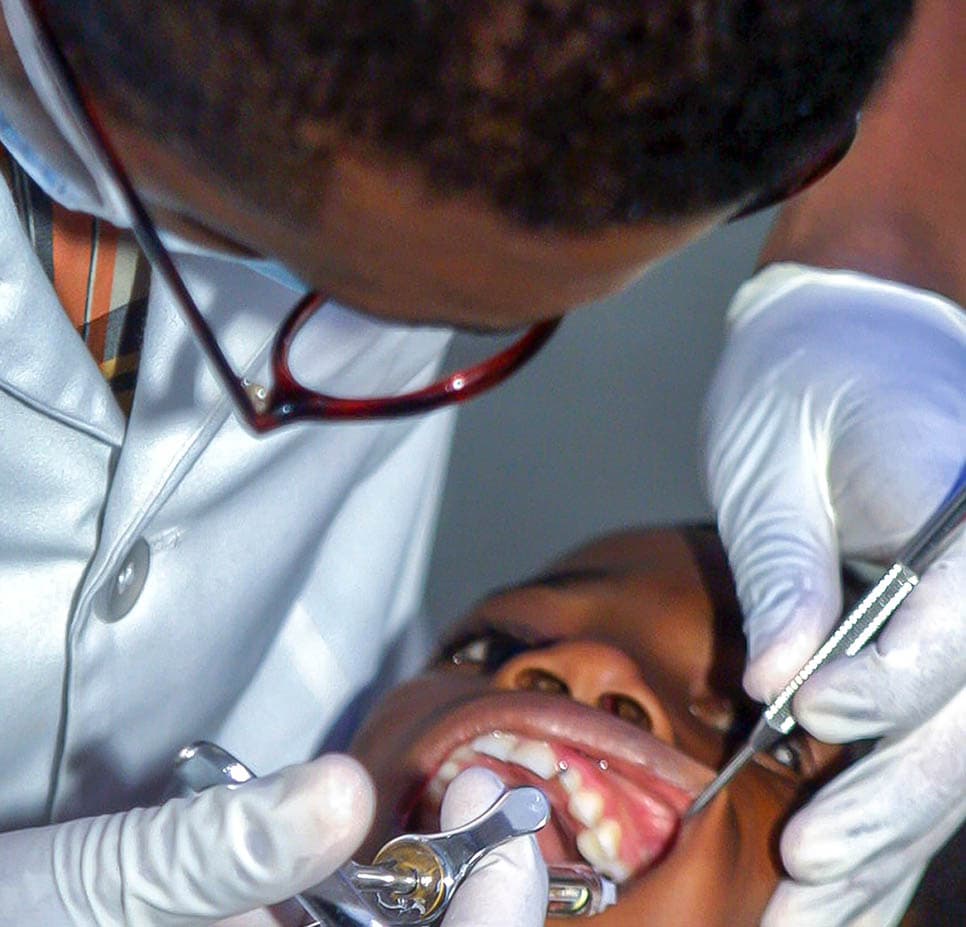 Everything you need to know about dental implants